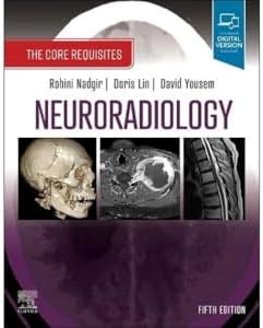 Osborn's Brain: 9780443109379: Medicine & Health Science Books