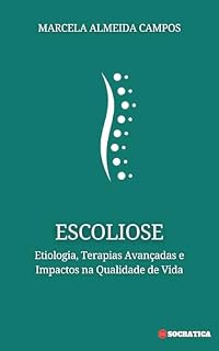 Livro Escoliose: Etiologia, Terapias Avançadas e Impactos na Qualidade de Vida (Viva com Saúde: Série Completa de Guias Essenciais para o Bem-Estar e Qualidade de Vida)