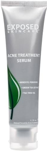 Acne Treatment Serum by Exposed Skin Care