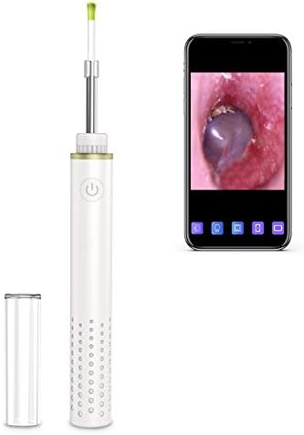 Wireless Otoscope Ear Wax Removal Tool