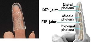 Open Air Stax Finger Splint Size #1 - Thumbnail 2