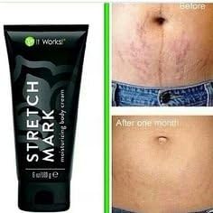 stretch mark moisturizing body cream
