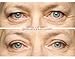 EasyLift The Original 60 Second Eye Lift | As Seen On TV | Lab Tested For Save Everyday Use | Made In the USA