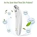 Electric Blackhead Remover, Pore Vacuum Suction Facial Acne Cleaner Tool with 4 Probes and 4 Adjustable Suction Level