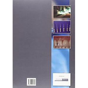 Conservadora, periodoncia, cirugía e implantes