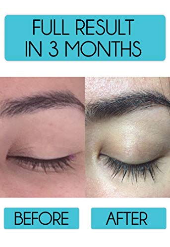 image for Beautyca Eyelash Growth Serum Eyebrow Growth - Lash Boost - Best Eyela