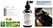 L'emarie Hair Growth Treatment Spray - Hair Loss Prevention Treatment For Men & Women, Anti-Hair Loss, Thicker, Fuller, Healthier Hair For Thinning Hair, Hair Loss 4fl oz