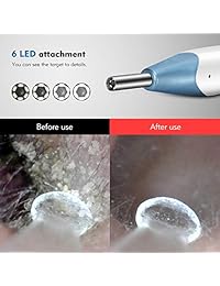 TSAAGAN   Endoscopio de limpieza de orejas, 3 en 1, USB, cámara digital de inspección de otoscopio de oreja HD, herramienta de limpieza de oreja con 6 luces LED para Android Smartphone, Viudas, Mac PC
