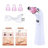 Blackhead Remover,Zoumo Portable Facial Pore Blackhead Acne Removal,Comedone Suction Extractor,Healthy Pore Vacuum Extractor,Rechargeable Comedo Remover,1 Set of 4 Tips(white)