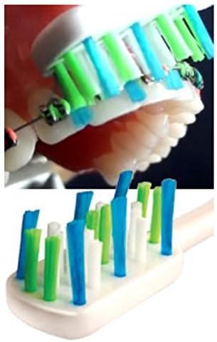 Easy Braces Orthodontic Toothbrush (Set Of 2) (Random Selection)
