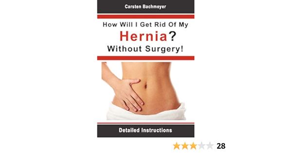 How Will I Get Rid Of My Hernia Without Surgery Detailed Instructions Bachmeyer Carsten 9783844804003 Amazon Com Books