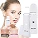 Skin Scrubber, LOZAYI Portable Exfoliator/Blackhead Remover Face Skin Spatula,Cutin Peeling instrument, Comedones Extractor Pimple Cleanser Rechargeable for Pore Deep Cleansing and Facial Lifting Tool