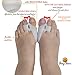BodyMoves Bunion Corrector 12-Piece Set with Reusable hot and Cold Gel Pack Big Toe Orthopedic Splint for Pain Relief, Hallux valgus Turf Toe Tailors Bunion Hammer Toe Straightener