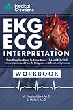 EKG/ECG Interpretation: Everything you Need to Know