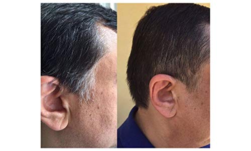 Hair Loss for Men - Gray Hair Reverse Complex - Natural Solution - Powerful Results, zinc Hair Vitamins, biotin Supplement, paba, biotin Supplements for Hair and Nails, Gray Hair Vitamins, 1B 60 Caps - Image 7