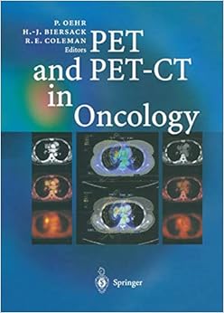 PET and PET-CT in Oncology: 9783540431251: Medicine & Health Science ...