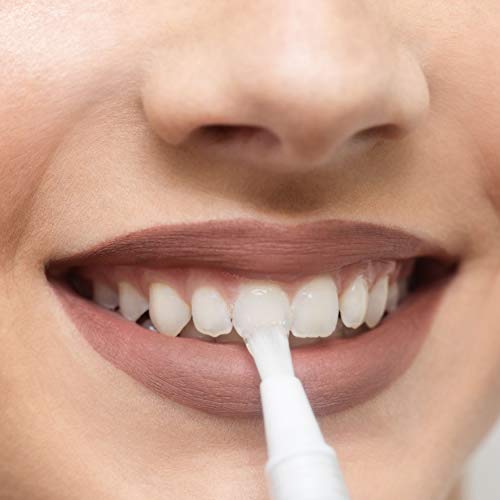 Avistar Professional Teeth Whitening Pens Instant Teeth Whitener Gel Pen Kit Chamomile