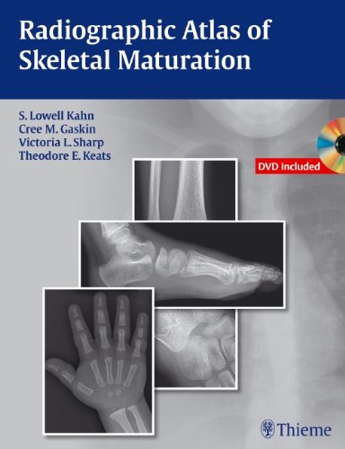 RADIOGRAPHIC ATLAS OF SKELETAL MATURATION