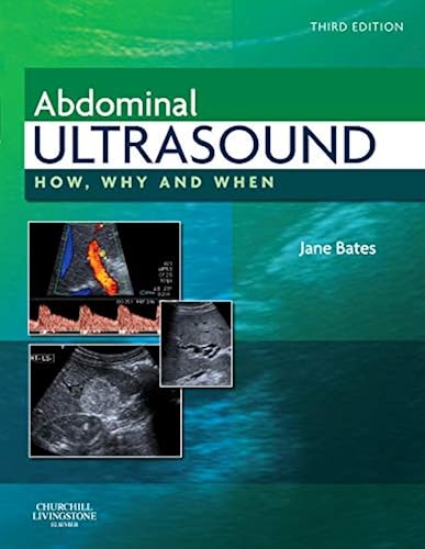 Download Abdominal Ultrasound: How, Why and When PDF