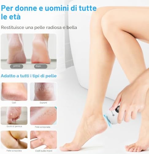 Mini Pedicure Elettrico, Calli Piedi Rimozione Con Regolazione A 3 Velocità Pedicure Elettrico Professionale Piedi,Testa Di Rettifica In Metallo×2，Cavo Dati×1，Borsa Portaoggetti×1，Spazzola×1