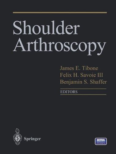 Shoulder ArthroscopyFrom Springer