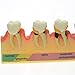Easyinsmile Dental Periodontal Disease Assort Teeth Model Teaching Education Study Tooth Model