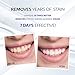 Teeth Whitening Pen - 2 Pack - 35% Carbamide Peroxide Gel - Easy-to-Use - Affordable - Removes Years of Teeth Stains - Gentle Ingredients - Travel-Friendly