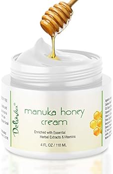 egyptian magic cream rosacea
