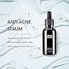 IMIM-Acne-Treatments-Serum-Double-Strength-Spot-Blemishes-Blackheads-Removal-Treatment-Suitable-for-Prone-to-Acne-Face-Serum-for-All-Skin-Types IMIM Acne Treatments Serum Double Strength Spot Blemishes Blackheads Removal Treatment Suitable for Prone to Acne Face…