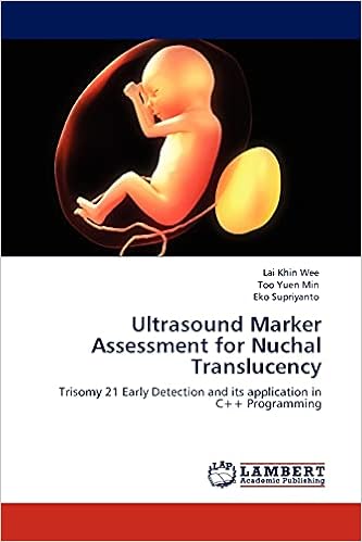 Ultrasound Marker Assessment For Nuchal Translucency Trisomy 21 Early Detection And Its Application In C Programming Khin Wee Lai Yuen Min Too Supriyanto Eko 9783845432212 Amazon Com Books