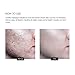 Scar Removal Cream - Advanced Treatment for Face & Body, Old & New Scars from Cuts, Stretch Marks, C-Sections & Surgeries - With Natural Herbal Extracts Formula
