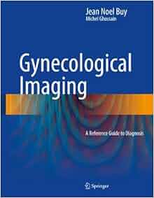 Gynecological Imaging A Reference Guide To Diagnosis