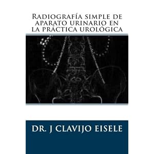 Radiografia simple de aparato urinario en la practica urologica. (Spanish Edition)