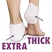 Ballotte Plantar Fasciitis Treatment, Heel Pain Relief Protectors 2 pairs
