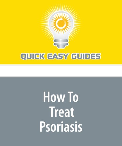 How To Treat Psoriasis