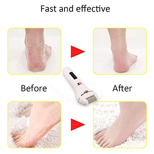 Electric-Foot-File-IPX5-Waterproof-Foot-Files-for-Hard-Skin-Remover-with-2-Rollers-and-2-Speeds-with-LED-Power-Display-Foot-Care-Pedicure-Tool-Make-The-Foot-Beautiful-and-Particularly-Smooth