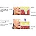 Guapa Atomization Device Needles-Free Pain-Free Anti-Wrinkle Skin Rejuvenation Beauty Machine Adjustable High Pressure Hyaluron Pen (1pc Hyaluron Pen+5pcs 3ml Syringe+1pc Needle)