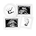 Pearhead Baby Collage Keepsake Babyprint Frame, Gender-Neutral Baby Nursery Decor for New and Expecting Moms, Includes Clean-Touch Ink Pad, White