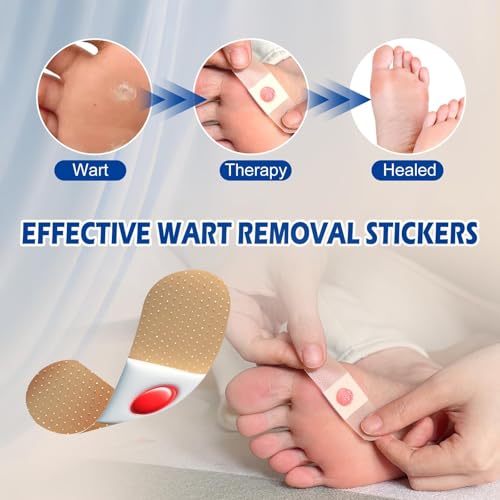 LBOYLOVE® 42 Pack Wart Corn Remover Pads for Feet, 40% Salicylic Acid Wart Remover Pads, Corn Removers for Toes, Extra Strength Bandages for Plantar Warts, Corns, Callus on Feet
