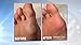 Laurent Personal pedi rechargeable foot callus remover, laurant, white, 13.4 Ounce