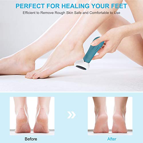 RRWKJ Replacement Roller, 2 Extra Coarse & 2 Regular Coarse Perfect Refill Heads in Personal Transparent Storage Box,Refill Heads for Electric Foot Callus Removers with Diamond Crystals(Black)