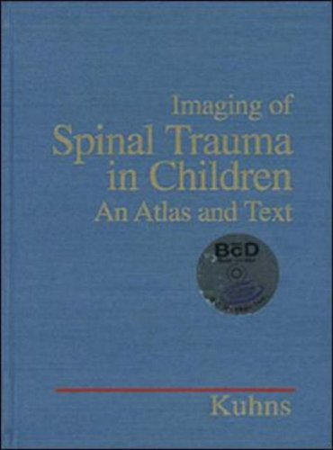 IMAGING OF SPINAL TRAUMA IN CHILDREN