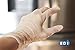 EDI Disposable Vinyl Gloves (Clear) - Powder-Free, Latex-Free (100, Small)
