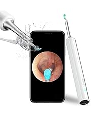 Ear Wax Removal Endoscope Otoscope, Earwax Remover Tools, Scope, with 1080P FHD Camera, 6 Led Lights, Wireless Connected, Compatible with iPhone, iPad, Android Smart Phones & Tablets
