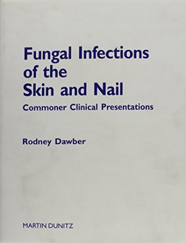 Fungal Infections of the Skin and Nail: slide atlas