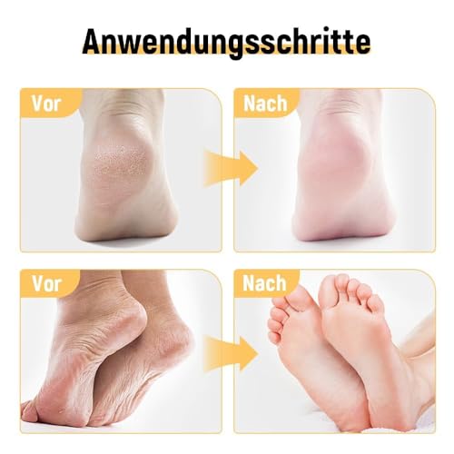 2025 Nuevo Crema Hidratante para Pies, Repara e Hidrata los Pies Secos y Agrietados, Exfoliating Moisturizing Foot Ointment, 40 ml (1)