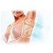 Dress Shield - Underarm Sweat Pads Dress Clothing Absorb Armpit Care Sweat Perspiration Pad High Absorbing Shield for Often perspire Women Lady - Skin Color