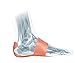 MUELLER Sports Medicine PFTape, Plantar Fasciitis Pain Relief Athletic Tape, Therapeutic Support for the Foot, Disposable, Latex Free, One-Time Use Bandages