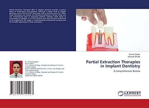 ITI Treatment Guide: Loading Protocols in Implant Dentistry