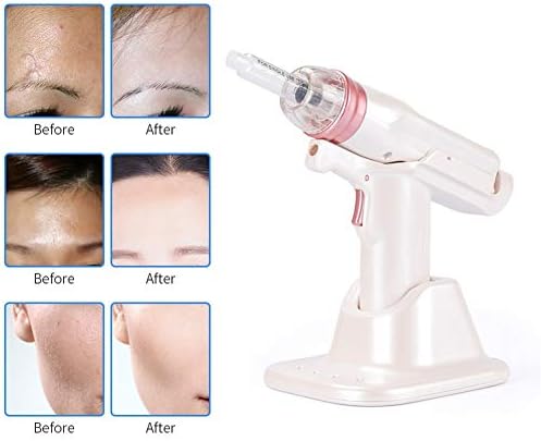 Hydrolifting Gun Mesotherapy EZ Negative Pressure Meso gun Mesotherapy Hydrolifting Water Injector Microcrystal Injection